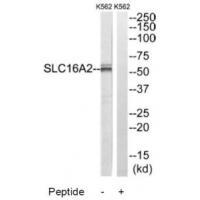 SLC16A2 Antibody[34808]