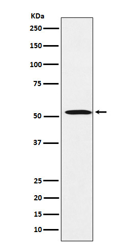 FADS1 Rabbit mAb[56916]