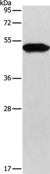 KRT81 Antibody[35630]