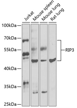 RIPK3 antibody[38654]