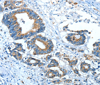 GLRA1 Antibody[37329]