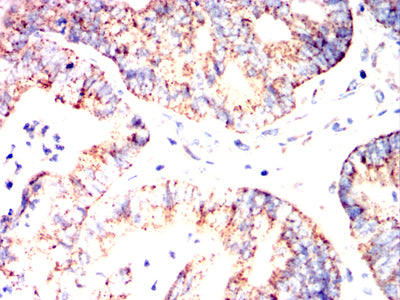 MUC13 Mouse mAb[63966]