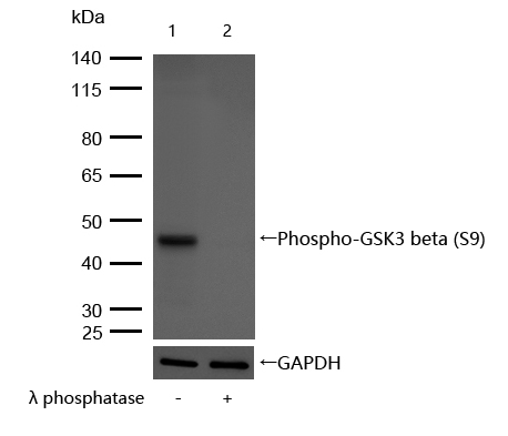 GSK3β(Phospho-Ser9) Rabbit mAb