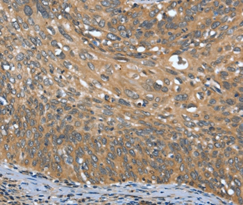 OPRD1 Antibody[37527]