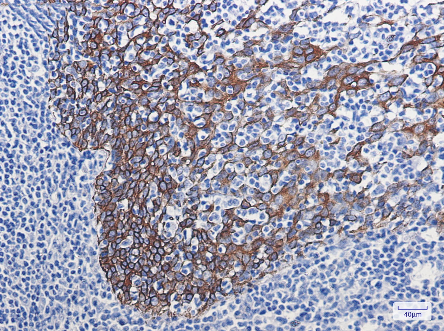 Cytokeratin 16 Rabbit mAb[5206