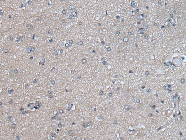 PLK4 Antibody[43523]