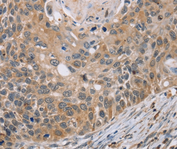 RIPK4 Antibody[37870]