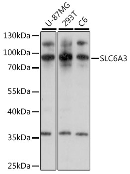 SLC6A3 Polyclonal Antibody[292
