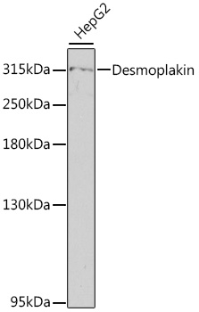 Desmoplakin Rabbit Polyclonal