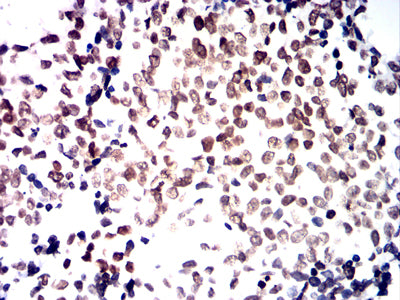 HNF4A Mouse mAb[63743]