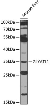 GLYATL1 Rabbit Polyclonal Anti