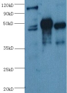 ENO2/NSE Monoclonal Antibody[4