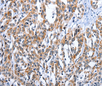EDN3 Antibody[35733]