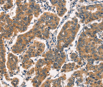 ARL6IP1 Antibody[36141]