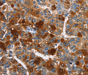 ARMCX2 Antibody[36262]