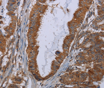 INSIG2 Antibody[36556]