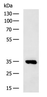 PIM3 Antibody[37701]