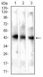 MAGEA4 Mouse mAb[63896]