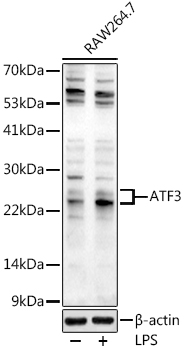 ATF3 Rabbit Polyclonal Antibod