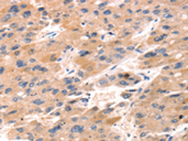 TAP2 Antibody[43156]