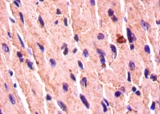 Bone morphogenetic protein 7 P