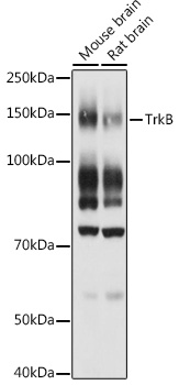 NTRK2 antibody[38362]