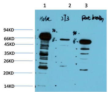Ubiquitin Mouse Monoclonal Ant