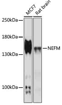 NEFM Rabbit Polyclonal Antibod