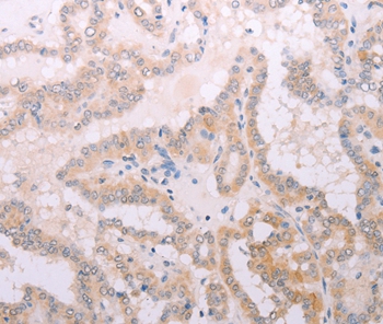 TPO Antibody[35966]