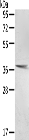 PTX3 Antibody[43163]