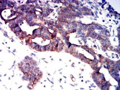 CD126 Mouse mAb[63237]