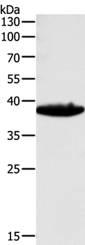 TGFB1 Antibody[35958]