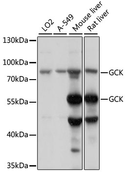GCK Rabbit Polyclonal Antibody