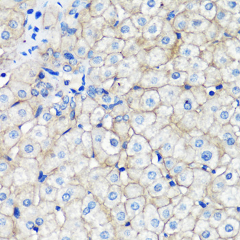 E-Cadherin Rabbit Polyclonal A