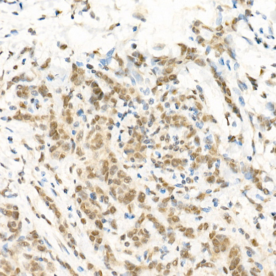 RGS2 antibody[38301]