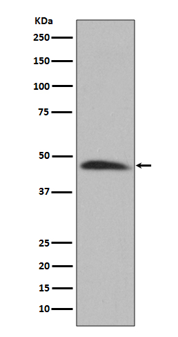 Hsp47 Rabbit mAb[56117]
