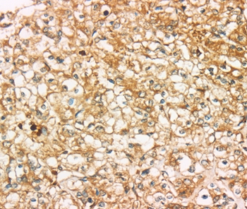 SIGLEC15 Antibody[37925]