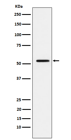 MMP1 Rabbit mAb[56490]