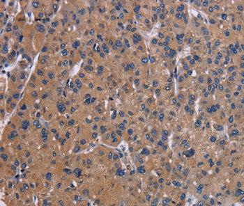 NPC1 Antibody[37774]