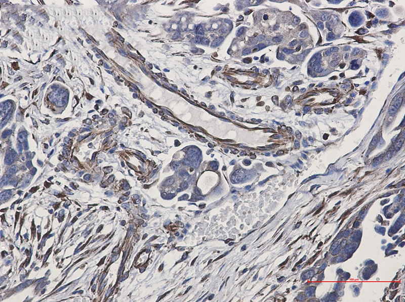 Cadherin Rabbit mAb[52486]