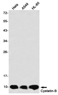 Cystatin B Rabbit mAb[52747]