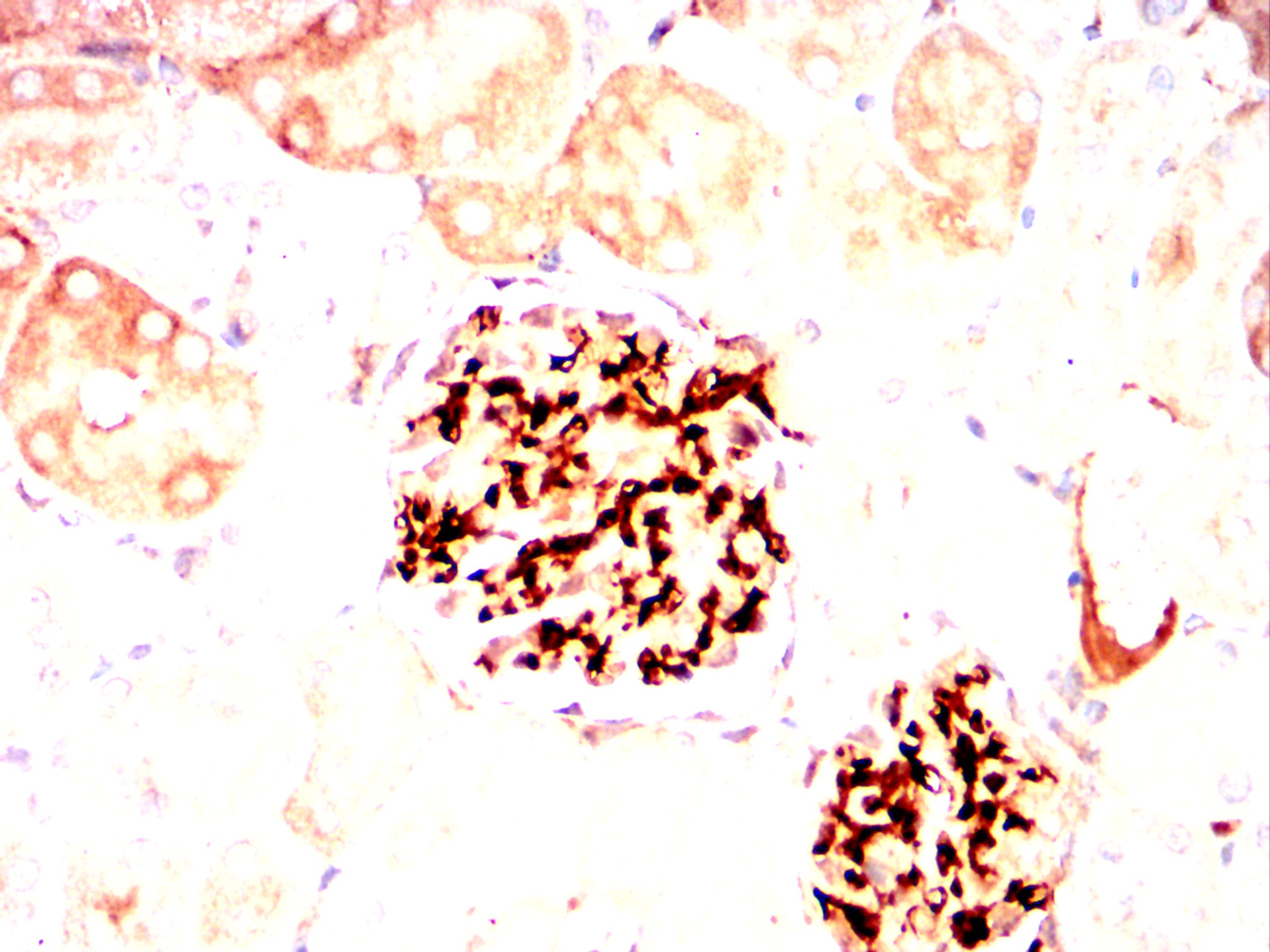 THY1 Mouse mAb[64315]