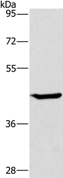 GCK Antibody[36499]