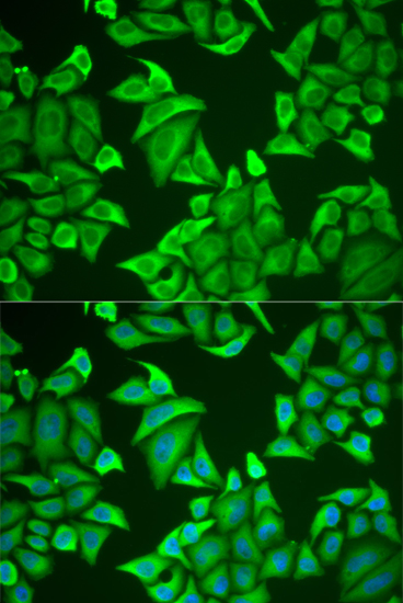 NGB antibody[38950]