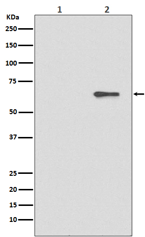 AMPK alpha 2 (Phospho-Ser491) 