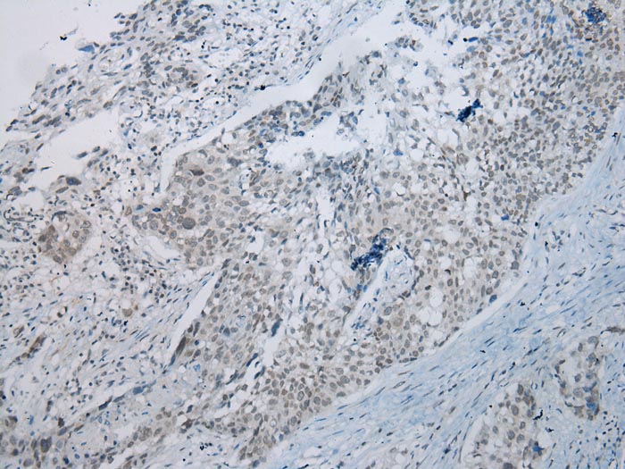 UBE2I Antibody[43252]