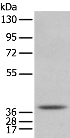 NUDT6 Antibody[43373]