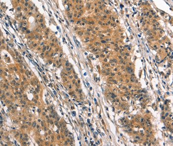 SMAD3 Antibody[37418]