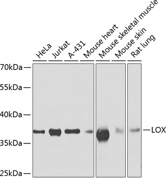 LOX Rabbit Polyclonal Antibody
