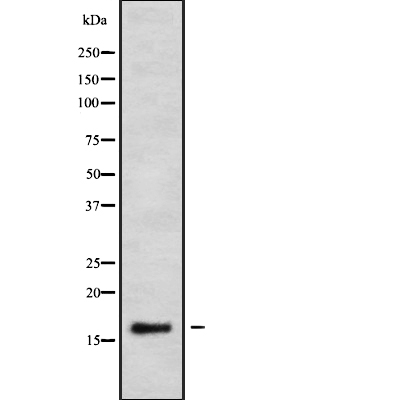 CALML3 Antibody[45833]